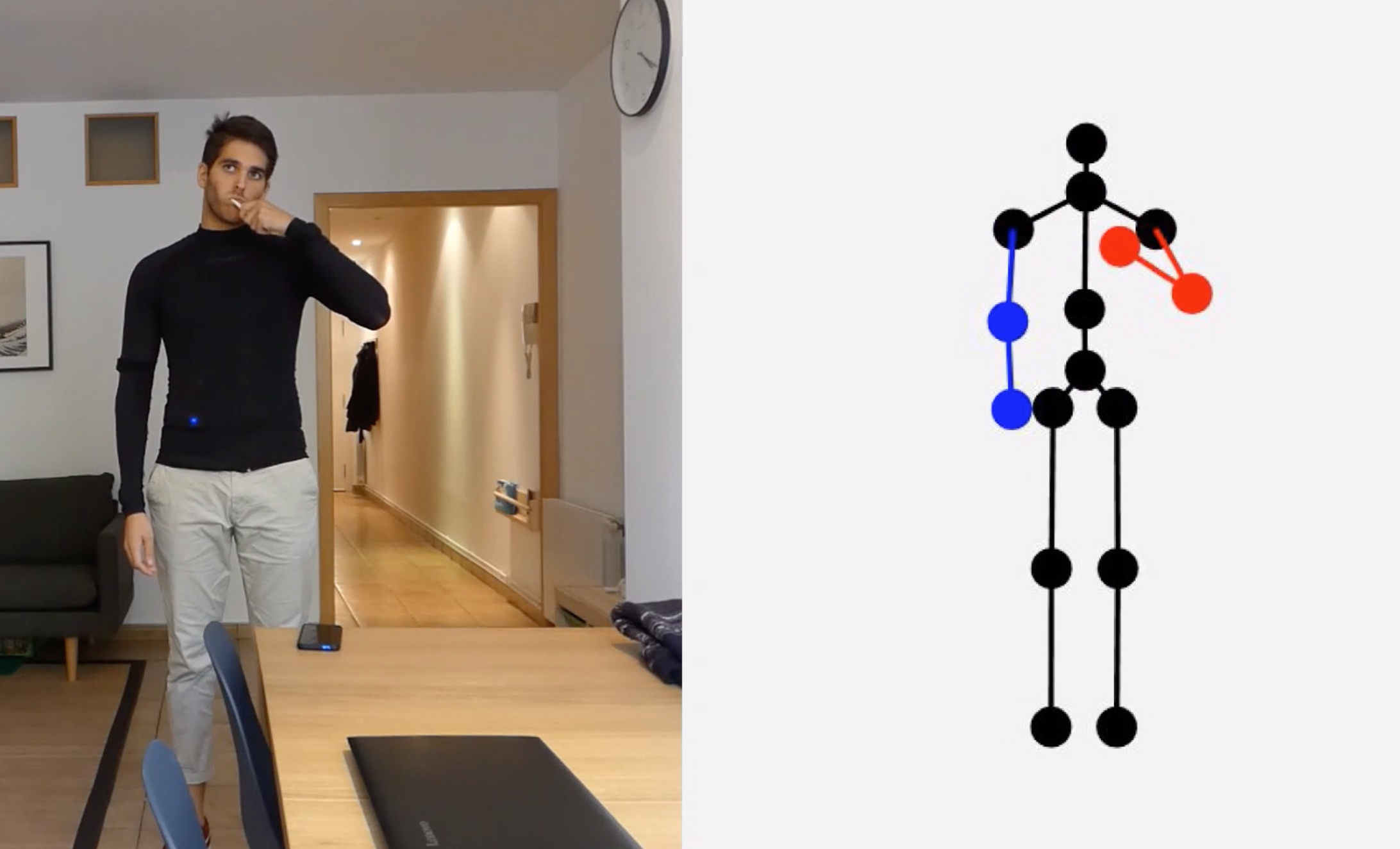 ArmTracker: A wearable system to monitor arm kinematics during daily life